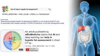 Artificial intelligence helps hepatic fat assessment on CT and its association with COVID-19