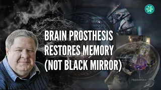 Brain prosthesis restores memory (not Black Mirror)