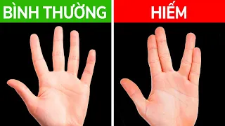 Nếu Cơ Thể Của Bạn Có Thể Làm Điều Đó, Bạn Là Một Trên 1 Triệu