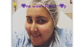 Post-Op RNY: Week 1 - my experience