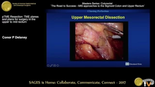 pTME Resection: TME planes & plans for surgery in the upper to mid rectum