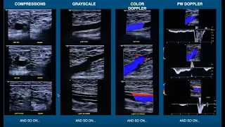 Introduction to Venous Insufficiency Exams