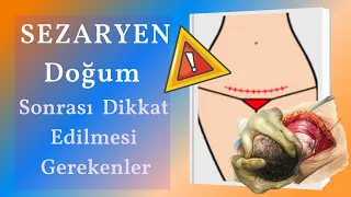 SEZERYAN DOĞUM SONRASI İYİLEŞME ⚕️💉 💊   (BAKIM- YEME-İÇME- BANYO- PANSUMAN-CİNSEL İLİŞKİ-EGZERSİZ)