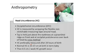 Anthropometry Measurements in Newborn | Pediatrics
