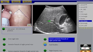 Ultrasound of the Liver 1 in Arabic