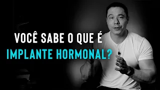 O QUE É IMPLANTE HORMONAL?| Dr. Luiz Tintori