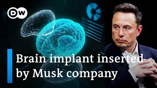 Elon Musk's start-up Neuralink implants first chip in human brain | DW News
