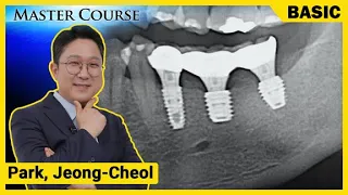 [Master Course Season2 - BASIC] Ultra-wide & short implant