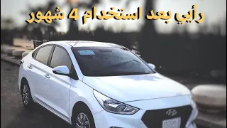 رأيي بعد استخدام 4 شهور للأكسنت الشكل الجديد🤔😦!