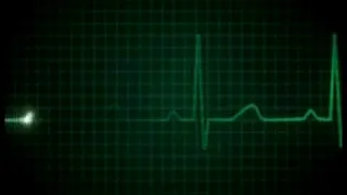 Heart beat going to death die | ecg | doctor | heart beat monitor