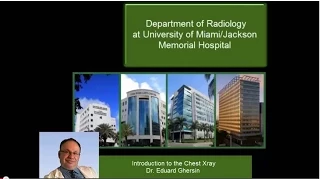 Chest Xray Approach