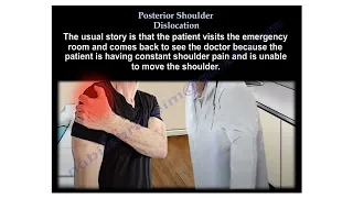 Posterior  shoulder dislocation