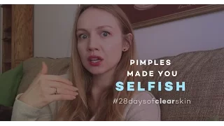 Your Selfishness Is Keeping You From Living With Purpose And Clear Skin | 28 Days Of Clear Skin