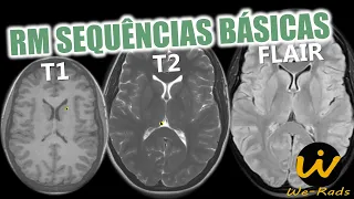 Sequências Básicas na Ressonância Magnética: T1, T2 e FLAIR