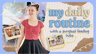 life with a feeding tube: my daily routine and tips!