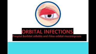 ORBITAL INFECTIONS #kanskiseries #2022 #2023