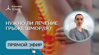 Нужно ли лечение грыже Шморля?