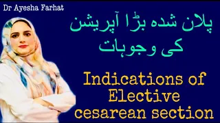 Elective Cesarean Section indications (پلان شدہ بڑا آپریشن کی وجوہات)