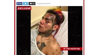 6IX9INE PISTOL WHIPPED, KIDNAPPED,ROBBED AND HOSPITALIZED