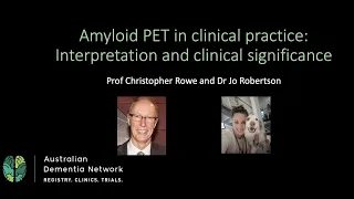 Webinar | Amyloid PET in clinical practice: Interpretation and clinical significance