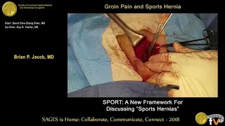SPORT: A new framework for discussing "sports hernias"