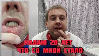 НАСВАЙ КИДАЮ 20 ЛЕТ