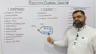 Polycystic Ovarian Syndrome Urdu/Hindi medium @prof.masoodfuzail| PCOS |