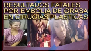 En Miami Mujeres Murieron Después de la Cirugía Plástica por Embolia de Grasa | Cirugia Extremas