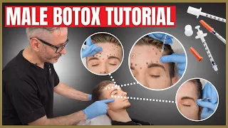 Botox Tutorial For Men | Botox Injection Patterns | Forehead, Corrugators & Crows Feet