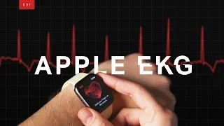 Why doctors are worried about the Apple Watch EKG