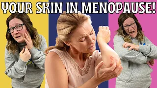 Surprising skin conditions in menopause and how to treat them. Skin related menopause symptoms.