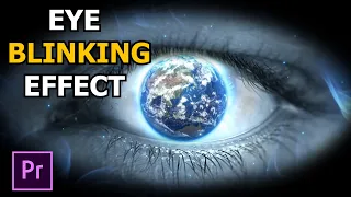 How To Make Eye Blinking Effect In Premiere Pro || Eye Opening Effect Premiere Pro Tutorial