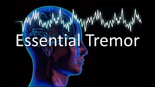 Essential Tremor