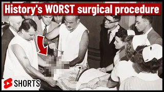 This is the WORST surgical procedure in history!