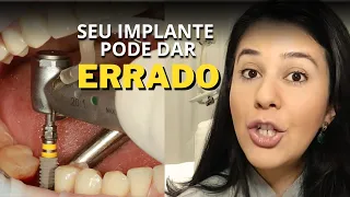 Não cometa esses 10 ERROS PERIGOSOS na hora de fazer um IMPLANTE DENTÁRIO