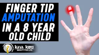 Finger Tip Amputation In a 8 Year Old Child