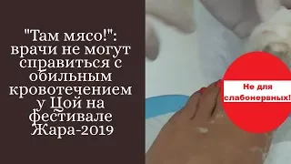 "Там мясо!": врачи не могут справиться с обильным кровотечением у Цой на фестивале Жара-2019