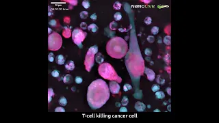 T Cells Killing cancer Cells