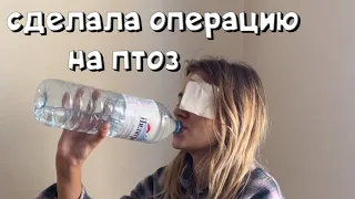 СДЕЛАЛА ОПЕРАЦИЮ НА ПТОЗ | ЭТО ТРЕШ