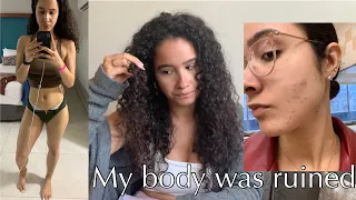 I LOST MY HAIR | DEALING WITH ANEMIA AND POOR MENTAL HEALTH | HAIR LOSS, WEIGHT LOSS, & ACNE