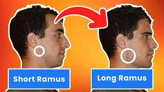The High Importance of The Ramus For The Jaw - (blackpill anaylsis)