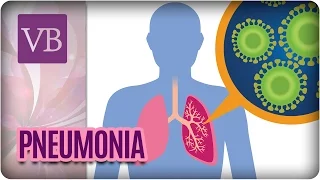 Pneumonia: Causas, Sintomas e Tratamentos - Você Bonita (17/04/17)