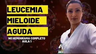 Como Identificar Leucemia Mieloide Aguda no hemograma completo #biomedicina #hematologia