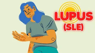 Systemic Lupus Erythematosus (updated 2023) - CRASH! Medical Review Series