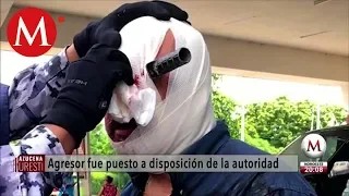 Le clavan cuchillo en el ojo por cajón de estacionamiento