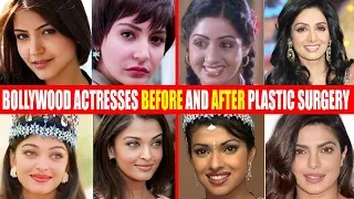 SHOCKING Plastic Surgery of Bollywood Actresses BEFORE & AFTER | Sridevi,Anushka,Aishwarya,Priyanka