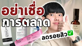 ลดรอยสิวอย่างถูกวิธี | ผลิตภัณฑ์ไหนเหมาะกับคุณที่สุด? #พลิกหลังกล่อง