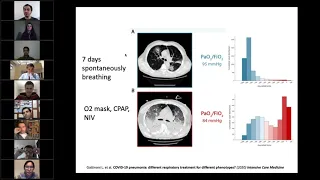 Ventilation and Lung Ultrasound in COVID-19 - Considerations for Cath Lab During COVID-19 Pandemic