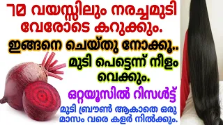 ഇനി ഡൈ വേണ്ട ബീറ്റ്റൂട്ട് മതി എത്ര നരച്ച തലമുടിയും കട്ടക്കറുപ്പാക്കാം പഴയകാല രഹസ്യം ഇങ്ങനെ ചെയ്യൂ