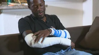 Hit-and-run survivor has message for the driver who hit him